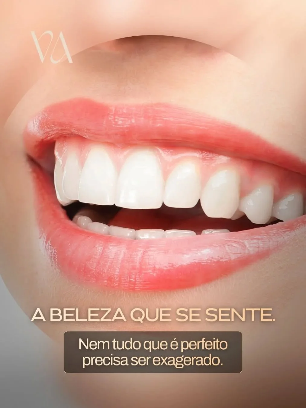 Nem toda beleza precisa ser evidente.
Algumas das transforma&ccedil;&otilde;es mais impactantes s&atilde;o aquelas que se sentem na confian&ccedil;a, na postura, no olhar.
Na VisaVis, buscamos naturalidade acima de tudo.
Seu sorriso deve combinar com