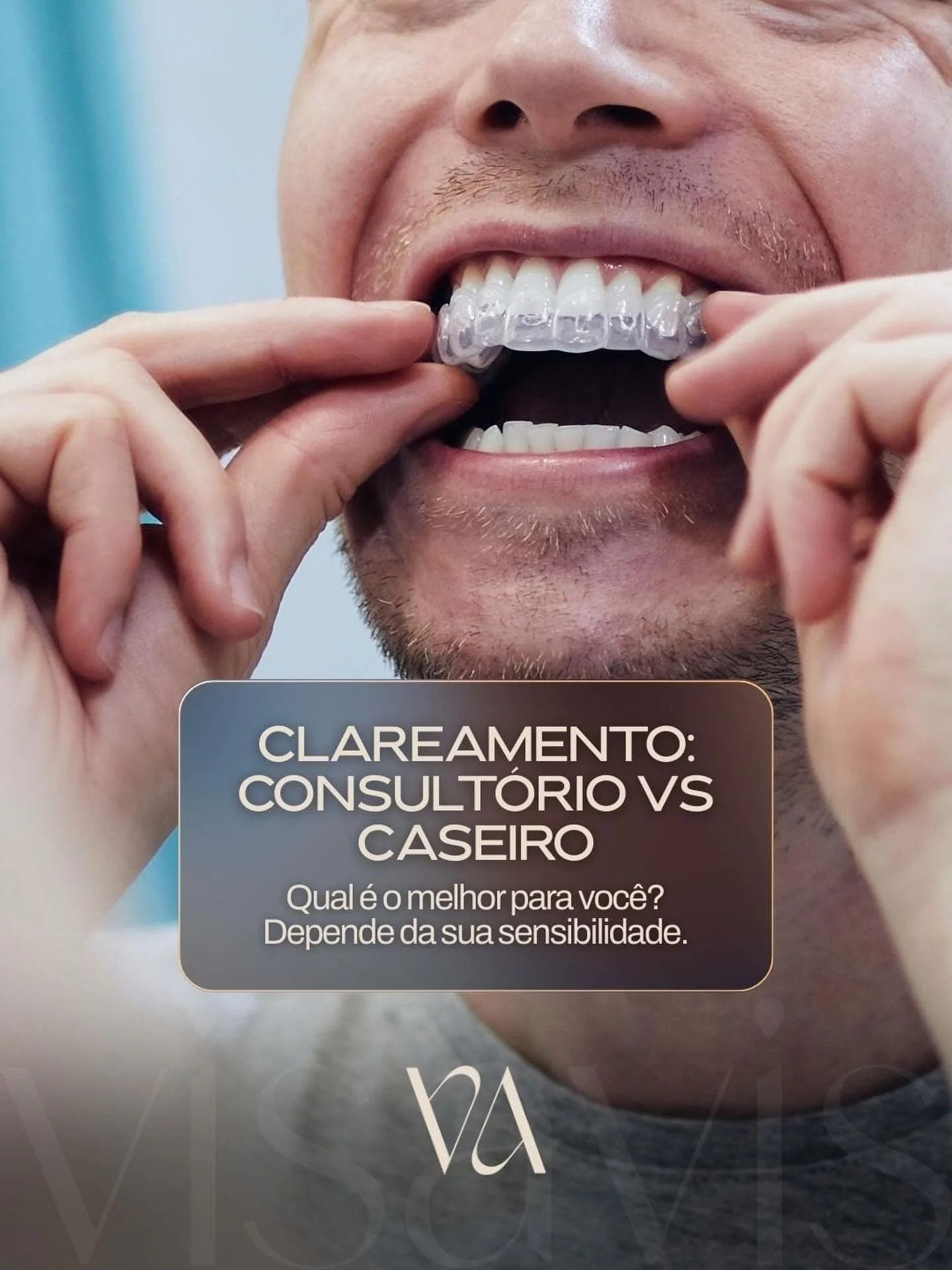 N&atilde;o existe f&oacute;rmula &uacute;nica.
Existe indica&ccedil;&atilde;o correta.

O clareamento em consult&oacute;rio proporciona resultados mais r&aacute;pidos.
O caseiro permite controle gradual e adapta&ccedil;&atilde;o para pacientes com se