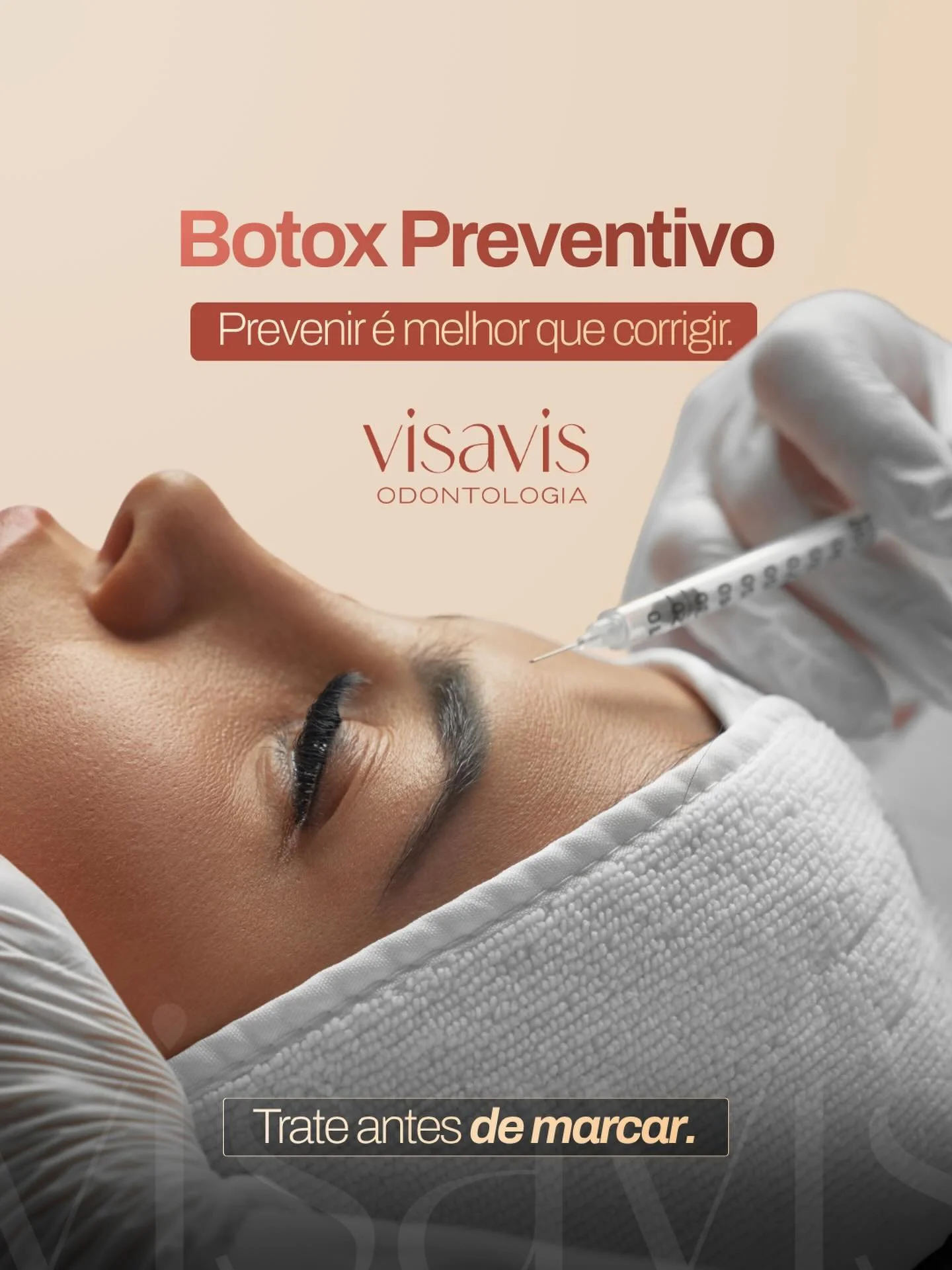 Linhas de express&atilde;o profundas n&atilde;o surgem da noite para o dia.
Elas s&atilde;o resultado de contra&ccedil;&otilde;es repetidas ao longo dos anos.
O Botox preventivo atua justamente nesse ponto: controla a musculatura antes que a marca se