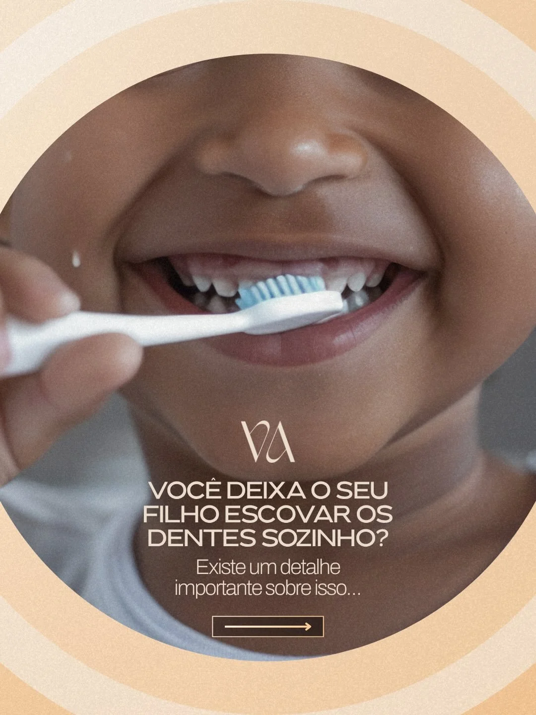 Voc&ecirc; deixa seu filho escovar os dentes sozinho? 🪥

At&eacute; os 8 a 10 anos, a supervis&atilde;o ainda &eacute; essencial &mdash; principalmente em crian&ccedil;as com aparelho.

A escova&ccedil;&atilde;o correta desde cedo faz toda a diferen