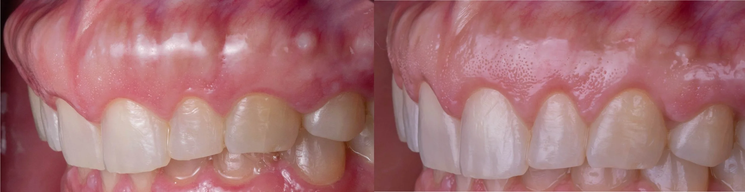Periodontia.jpg