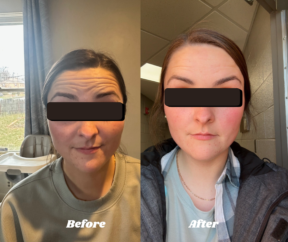 Konnor Before and After_2.png