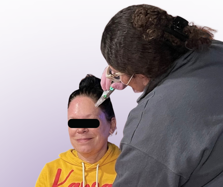 Microneedling Party_1 (1).png