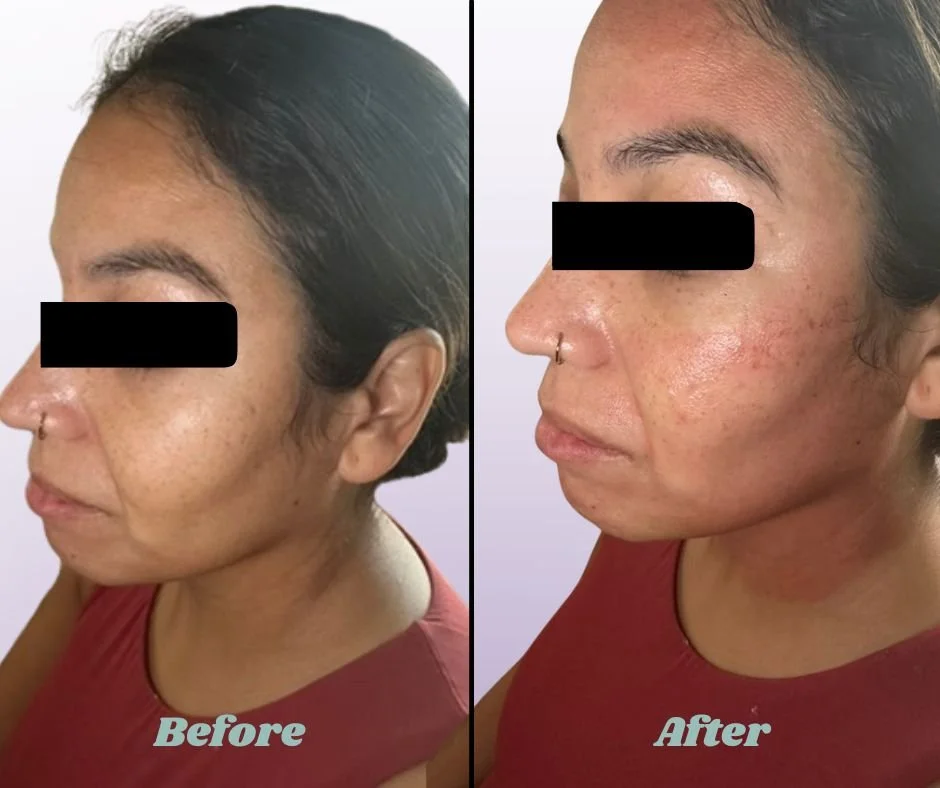 Before and After Michelle Website (1).jpg