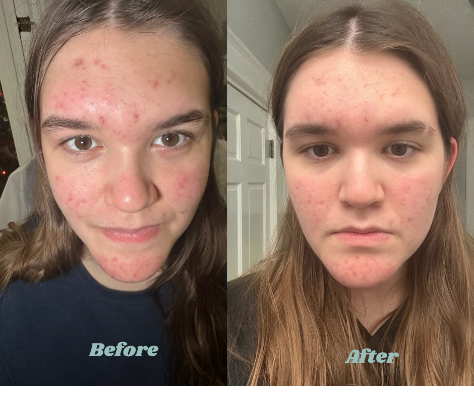 Before and After Emma.png