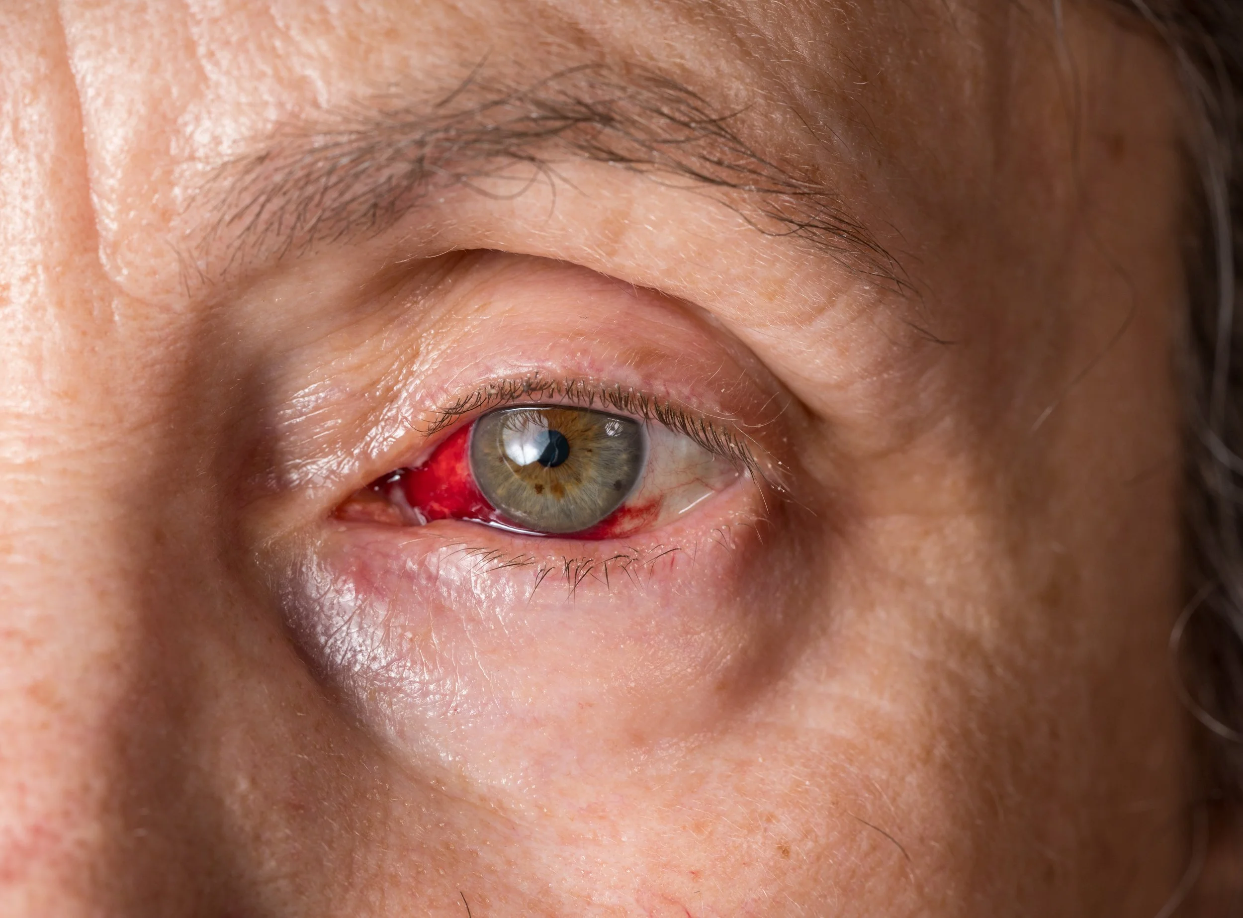 eye exam red eye optometry Las Vegas