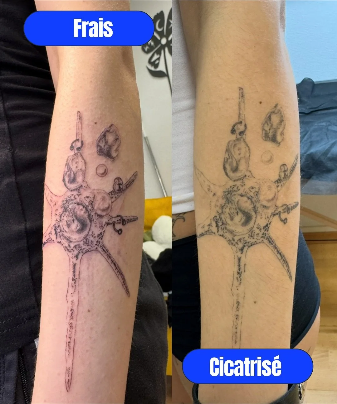 Compilation de tattoos frais vs cicatris&eacute; 
Aucun filtre et aucune retouche photo

J&rsquo;ai l&rsquo;habitude de retoucher les photos que je poste, en toute transparence, pour les rendre plus &ldquo;esthetiques&rdquo; sur mon feed : j&rsquo;au