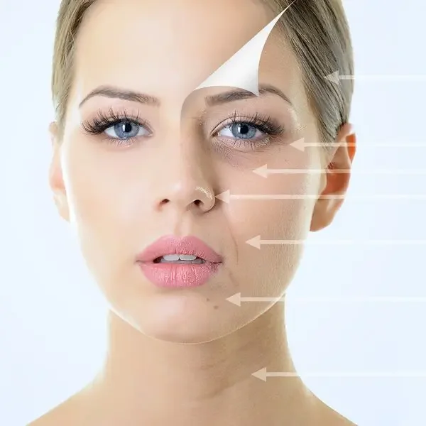 Close-up of a woman's face with labels pointing to different skin areas, illustrating skincare or facial analysis.