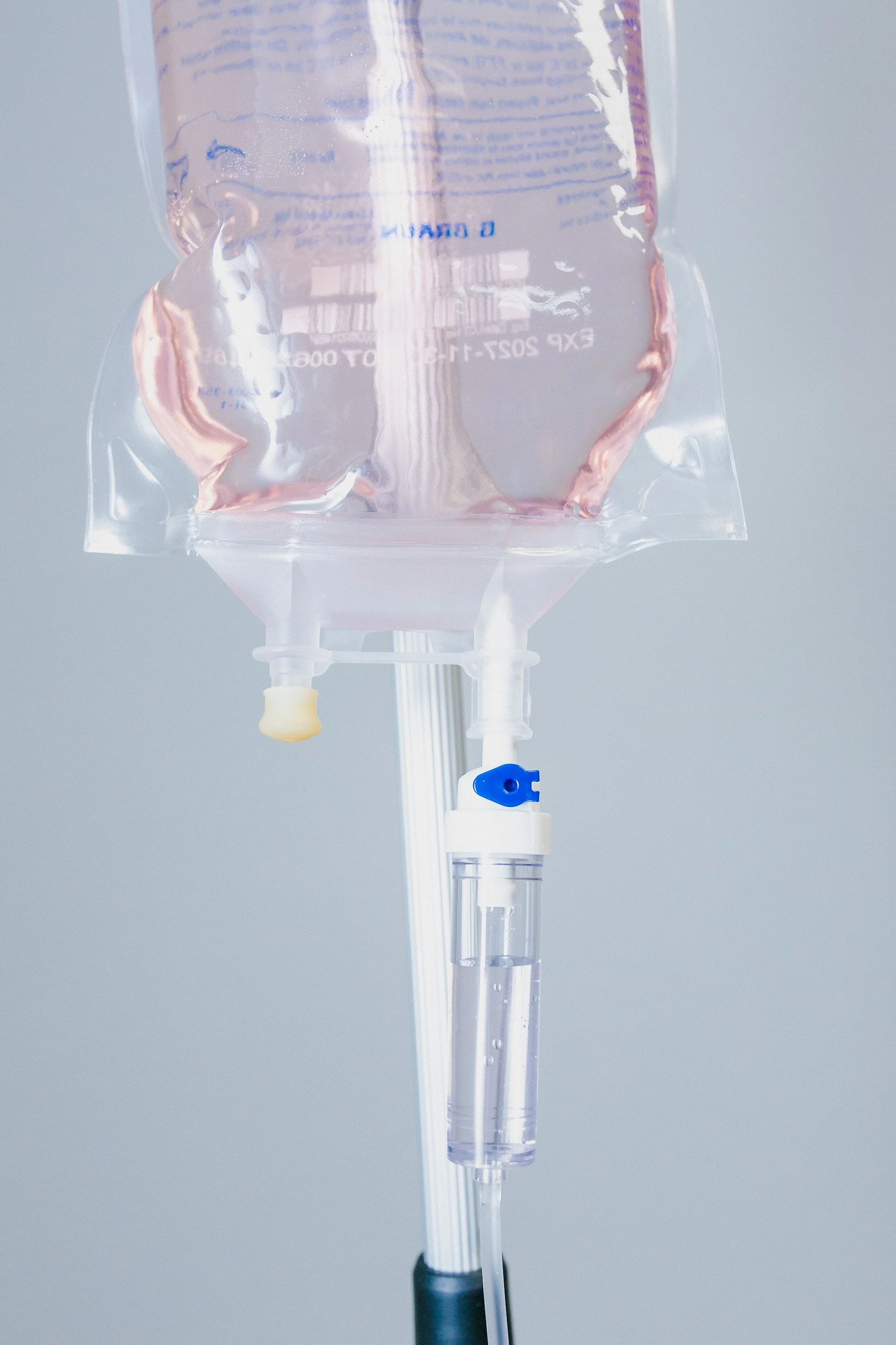 A close-up of an intravenous (IV) drip bag hanging with a tube and flow regulator, used for medical infusion therapy.