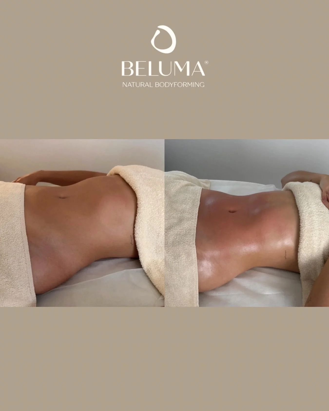 ✨ Was man sehen &amp; sp&uuml;ren kann ✨

Dieses Ergebnis kann durch brasilianische Lymphdrainage sichtbar werden.
Jeder K&ouml;rper reagiert individuell.

Was kann sich zeigen?
&bull; definiertere Konturen
&bull; glatter wirkende Haut
&bull; weniger