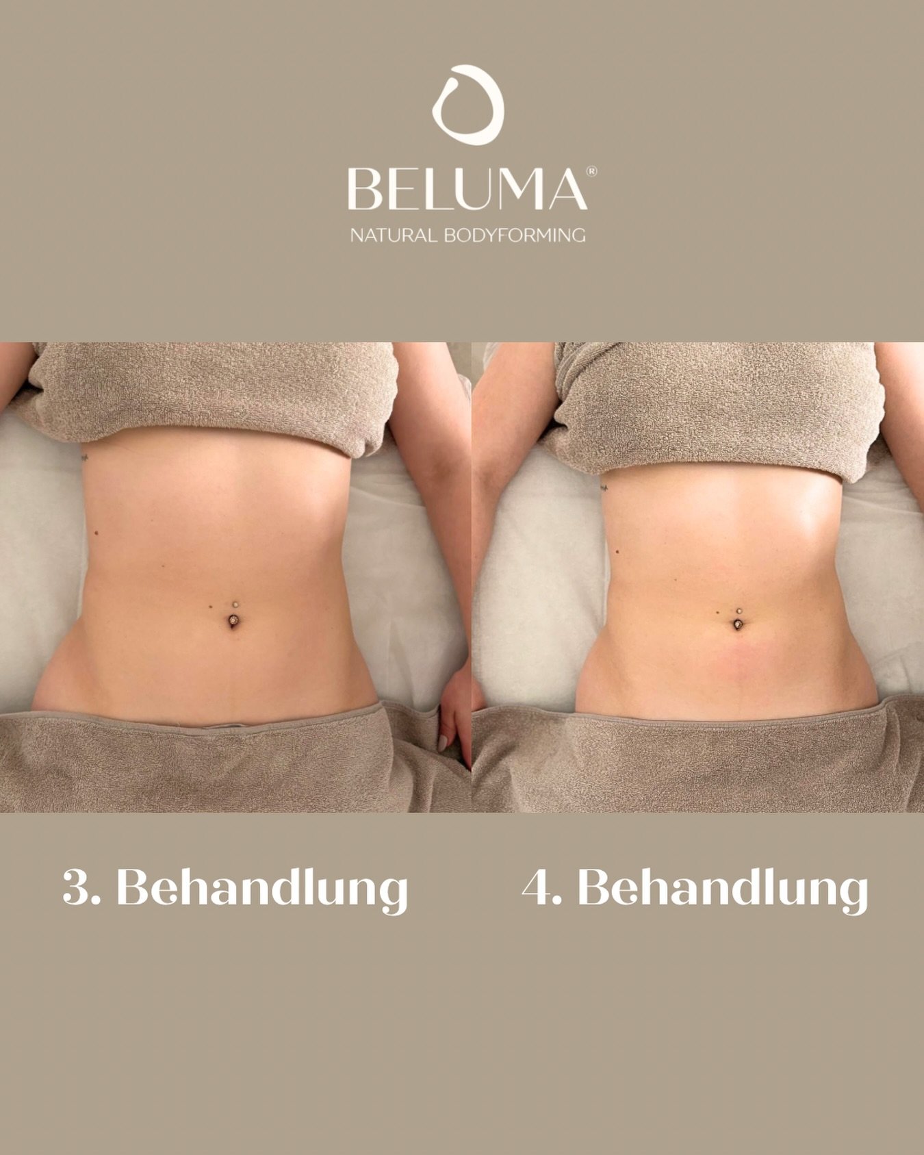 Regelm&auml;&szlig;igkeit macht den Unterschied ✨

Zwischen der 3. und 4. Behandlung sieht man wieder, wie der K&ouml;rper weiterarbeitet. 🤍
Die brasilianische Lymphdrainage ist keine &bdquo;Einmal-Behandlung&ldquo; &ndash; gerade durch regelm&auml;