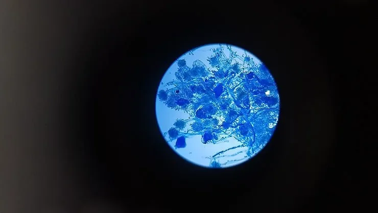 How Fast Does Mold Grow After A Water Leak?