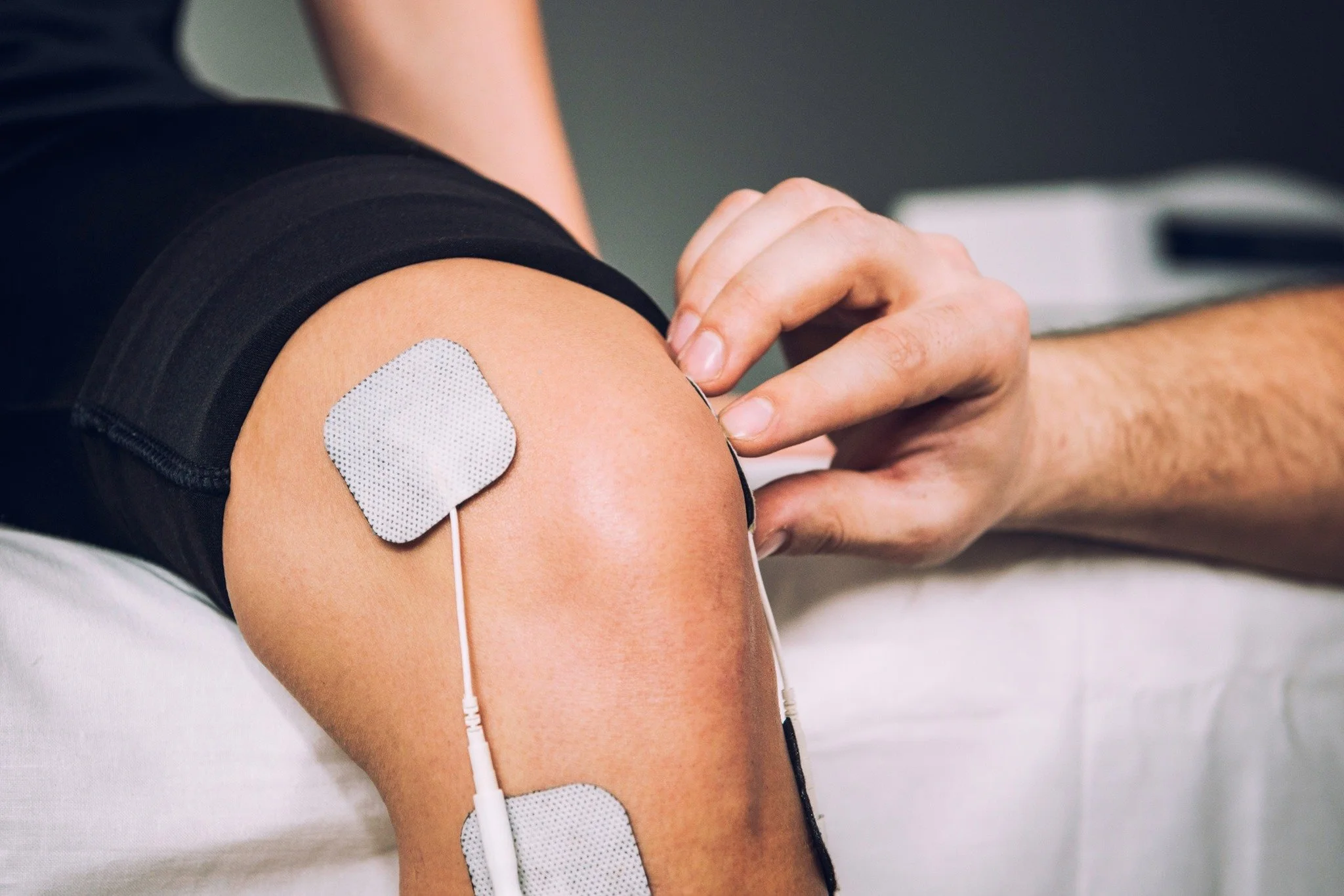 The Benefits of Electrical Stimulation for Improving Movement and Upper Limb Function After Stroke
