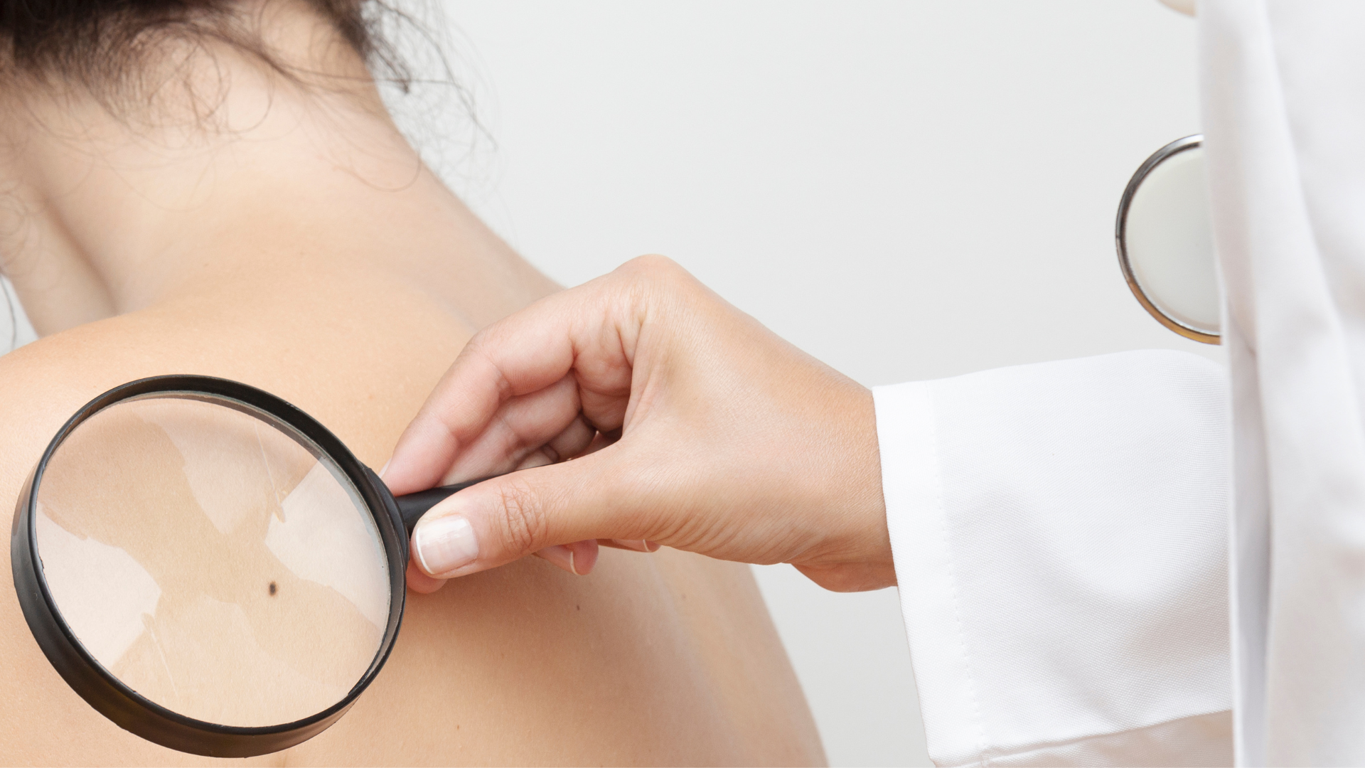 An Overview of Skin Cancer