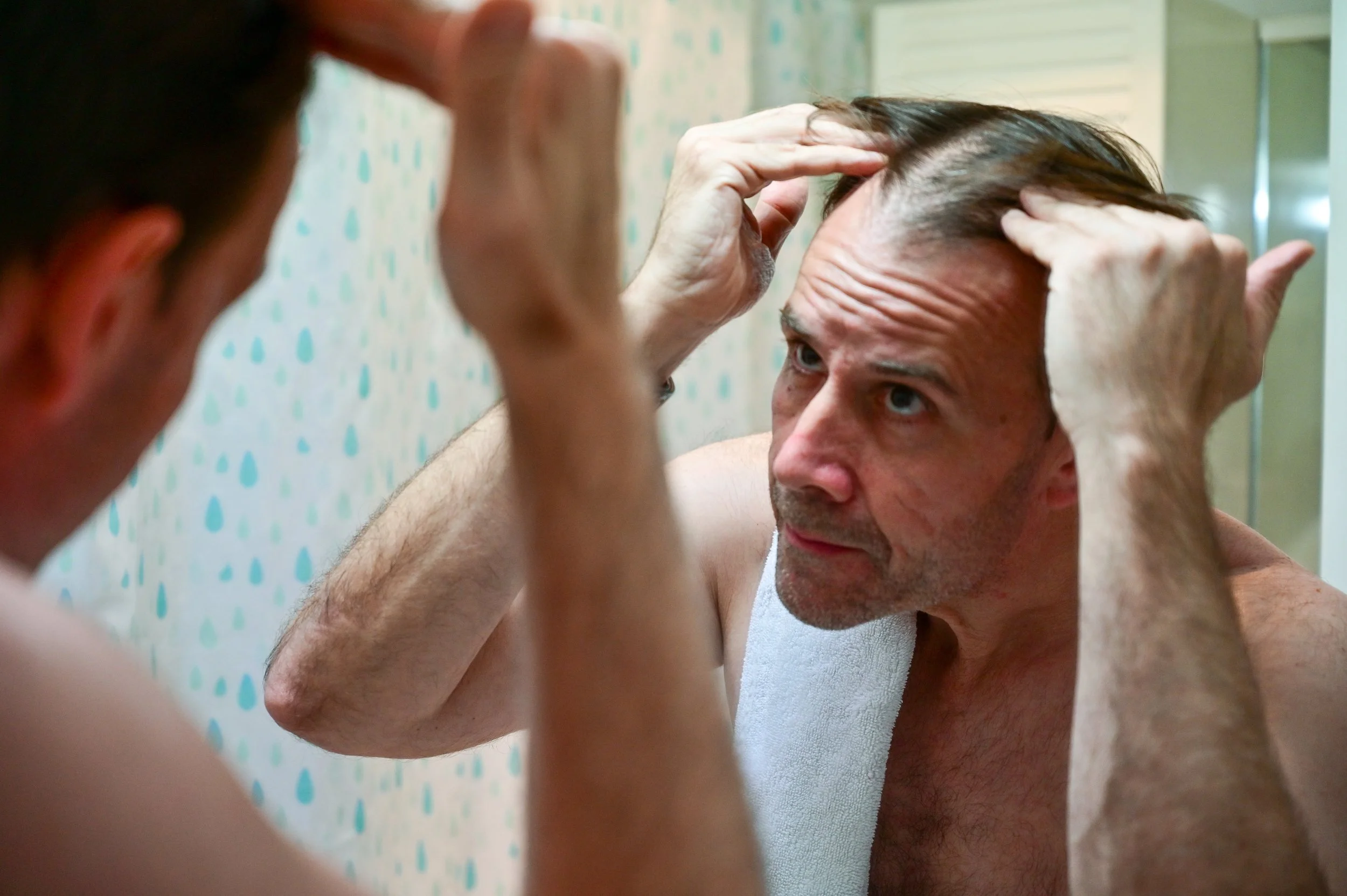 Testosterone Therapy and Hair Loss: What Men Should Know