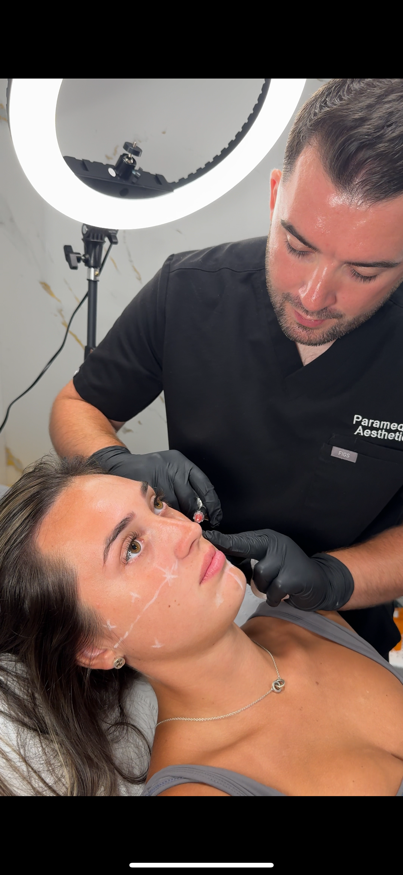 Skin Boosters