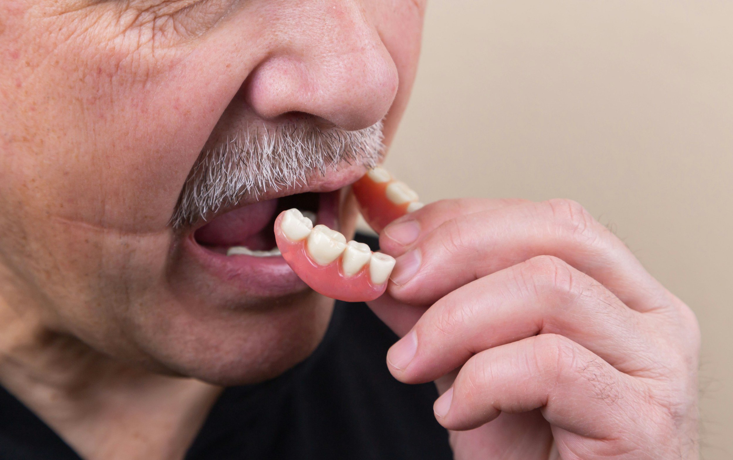 An elderly man with gray facial hair places a bottom denture into his mouth.