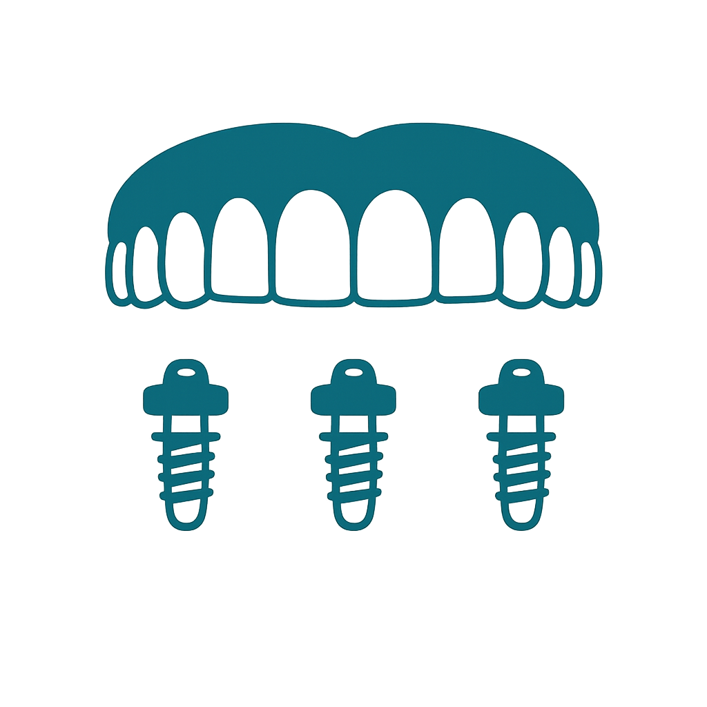 Implant Retained Dentures