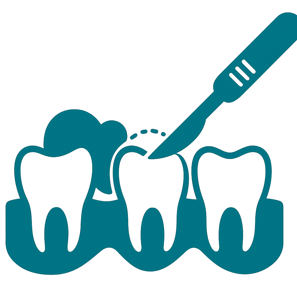 Gingivectomy to restore Gum Health