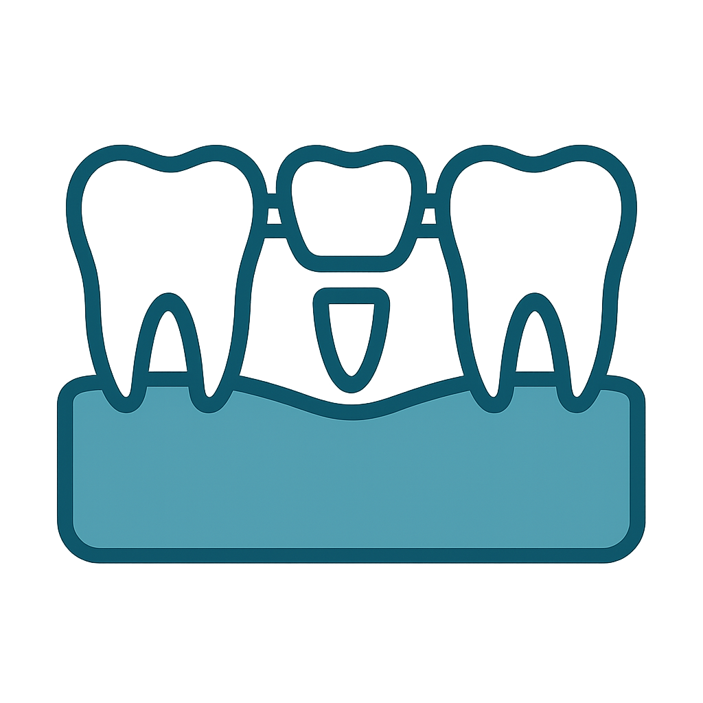 Dental Bridge using pontics