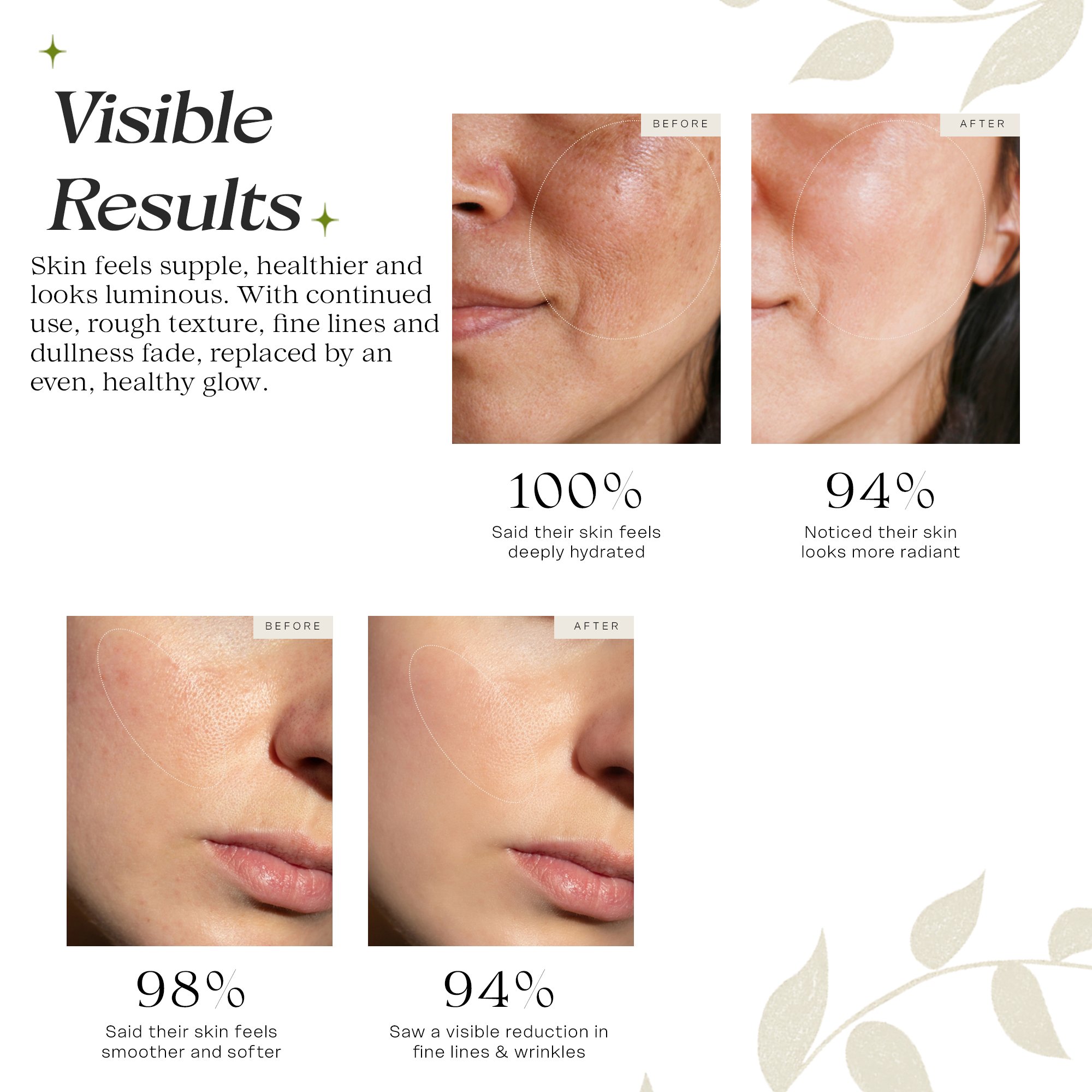 Hyluronic acid +B5Artboard 6.jpg