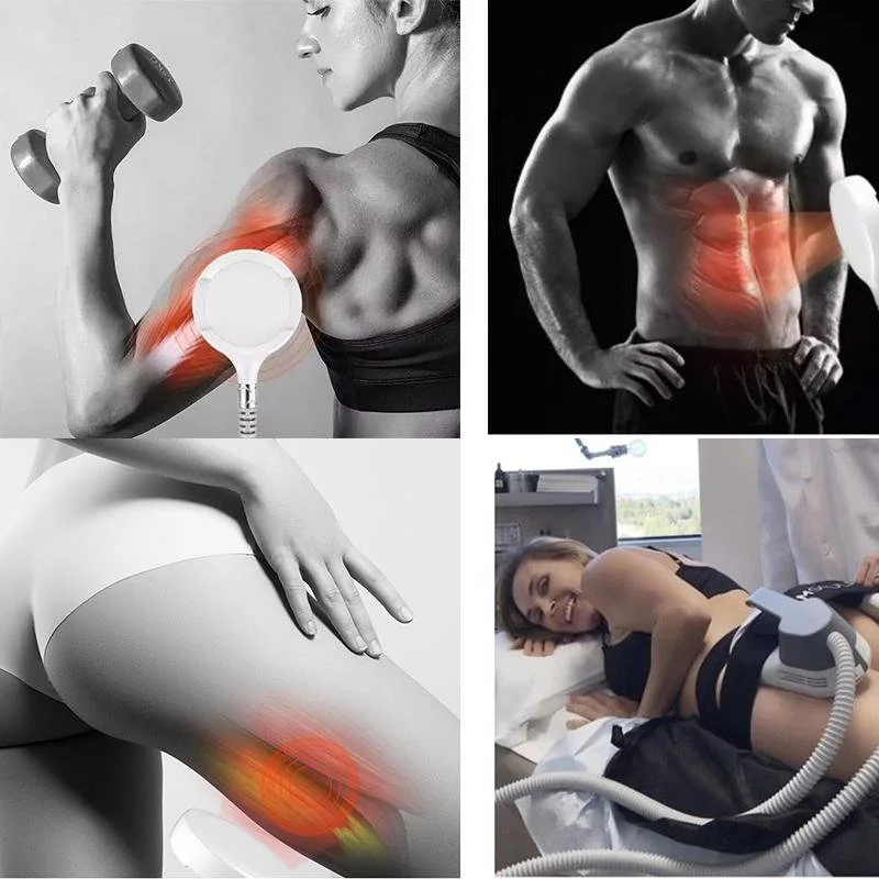 Collage of four images showing muscle pain or injury treatment. Top left: woman lifting dumbbell with shoulder pain highlighted. Top right: shirtless man with abdominal pain highlighted. Bottom left: hand touching thigh with pain highlighted. Bottom 