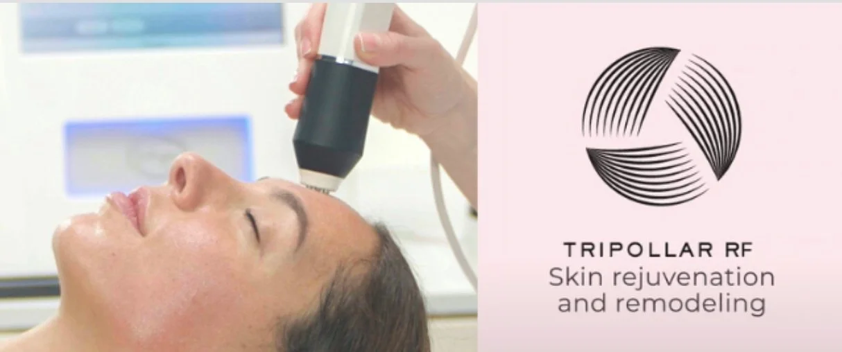 A woman receiving skin treatment with a handheld device, with a logo and text on the right side that reads 'TRIPOLLAR RF Skin rejuvenation and remodeling.'