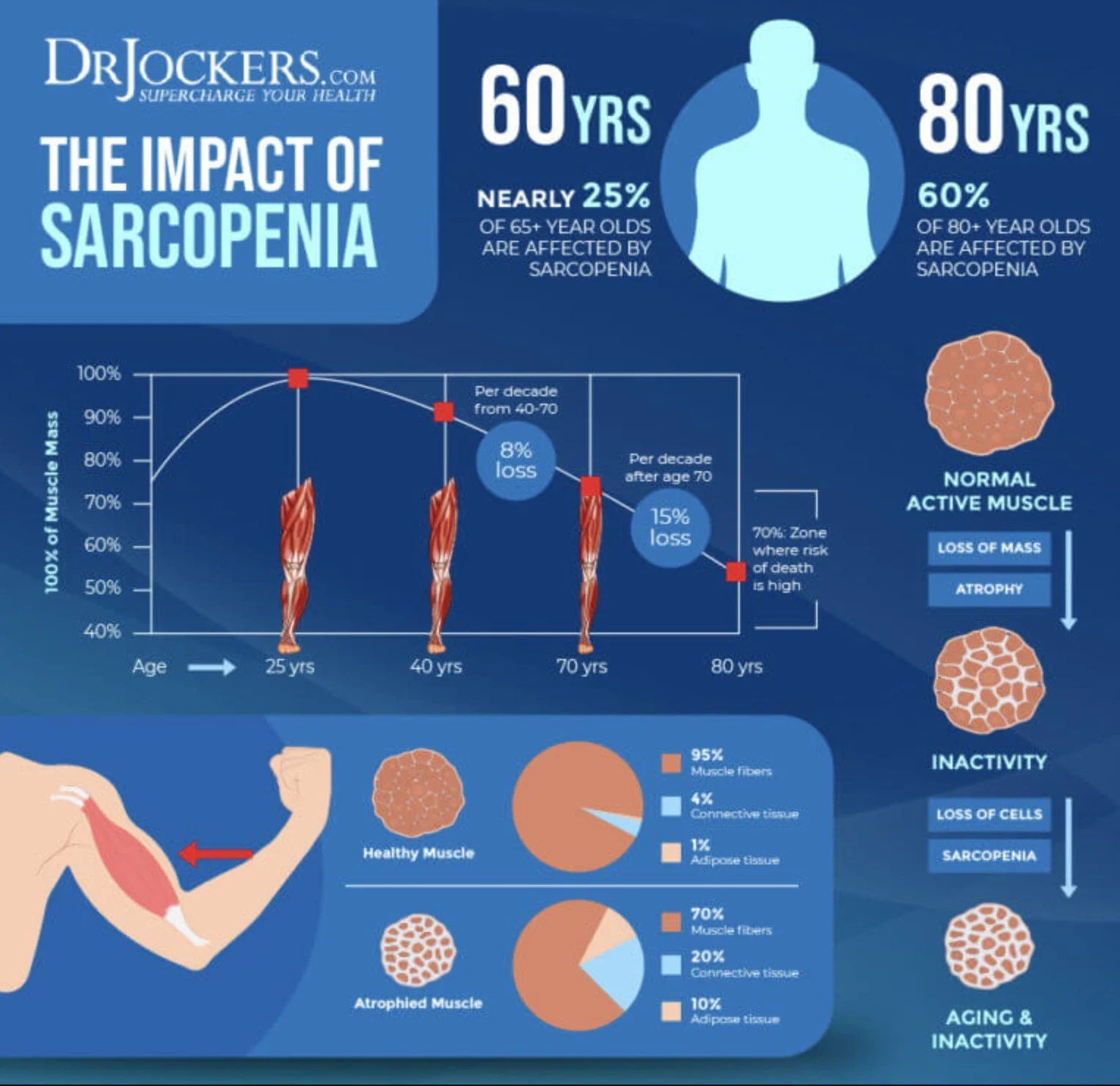 Infographic about sarcopenia, showing impact on muscle loss with age, affected percentages, and comparisons of healthy versus atrophied muscle tissue.