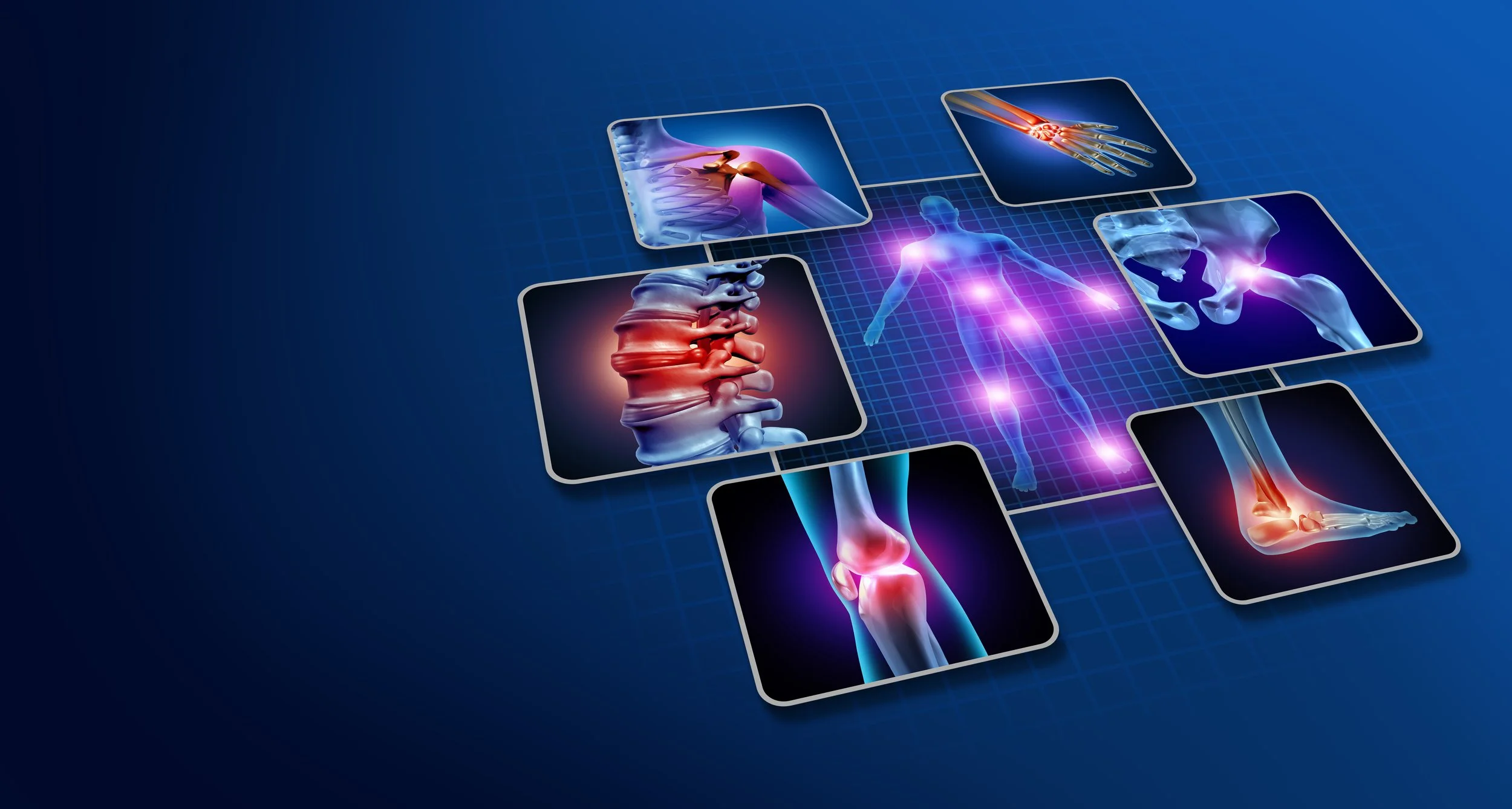 Digital illustration showing human body with highlighted joints, spine, knee, ankle, wrist, and hand, surrounded by images of skeletal and joint anatomy such as spine, knee, wrist, and ankle.