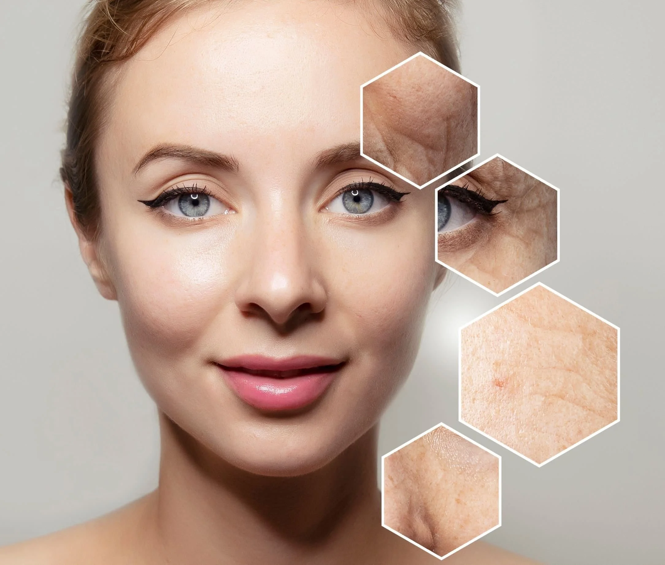 Close-up of a smiling woman's face with focus on skin texture, featuring three hexagon overlays highlighting areas of skin with wrinkles, pigmentation, and dryness.
