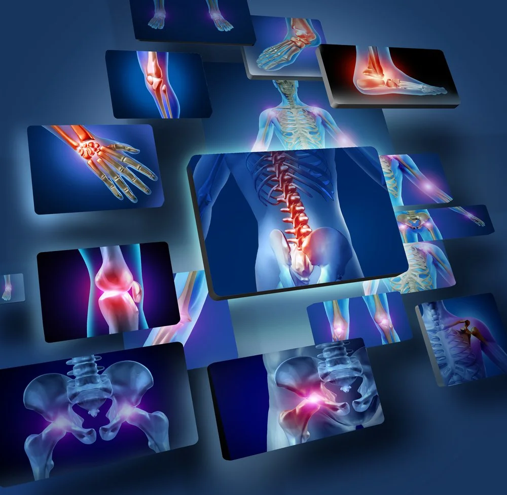 Digital medical illustrations of human bones and joints, including the spine, pelvis, knee, ankle, hand, and shoulder, displayed as floating images.