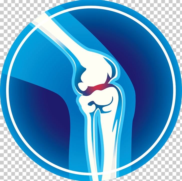 Illustration of a human knee joint with bones and cartilage.