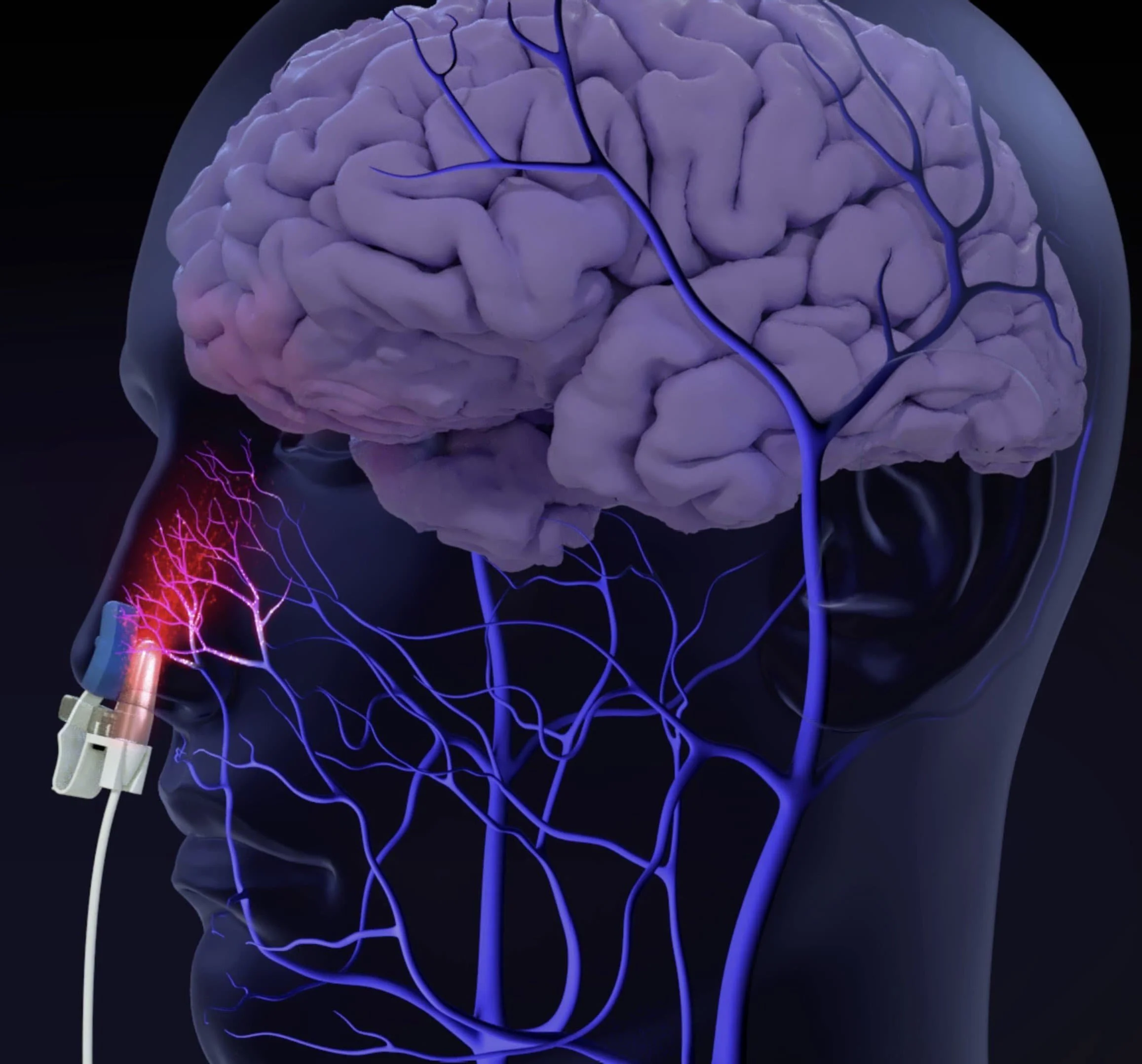 A digital illustration of a human brain, with an MRI or medical scan style, showing blood vessels and the nervous system inside the head. A medical device stimulates the brain through the nose.