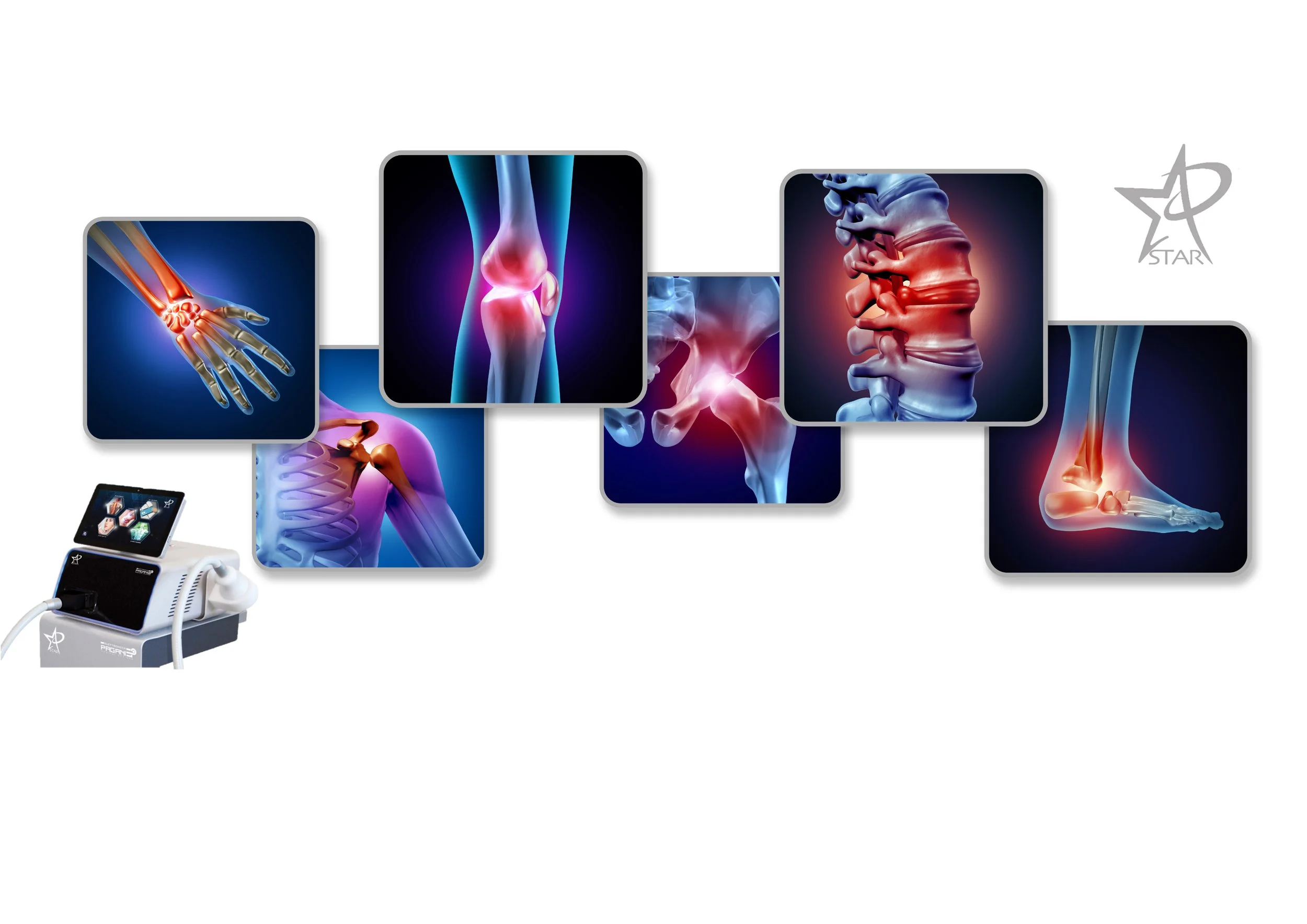 Medical equipment connected to a monitor displaying images of human joints and bones, highlighting joint pain and inflammation in various parts of the body including the hand, knee, spine, ankle, and foot.