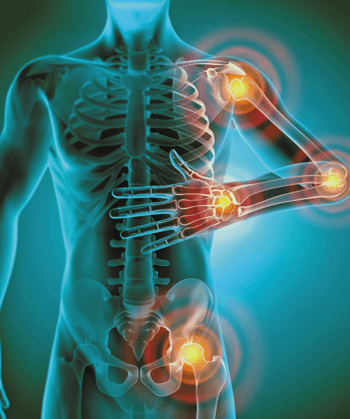 Digital illustration of a human skeletal system highlighting joints with glowing areas indicating pain or inflammation in the shoulder, wrist, and hip.
