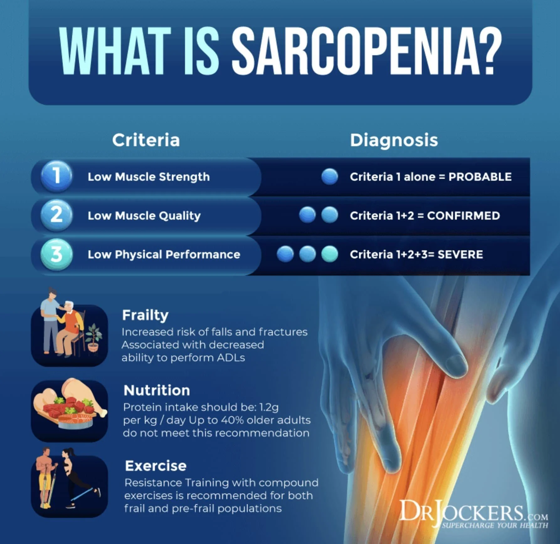 An infographic titled "What is Sarcopenia?" explains the criteria, diagnosis, and related factors. Criteria include low muscle strength, low muscle quality, and low physical performance. Diagnosis is probable with one criterion, confirmed with two, a