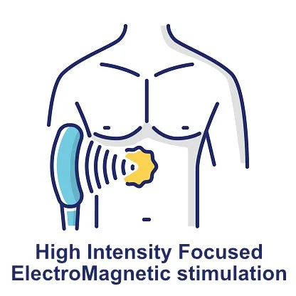 Diagram of a person's chest with a device emitting electromagnetic waves and a star-shaped object near the stomach, labeled 'High Intensity Focused ElectroMagnetic stimulation.'