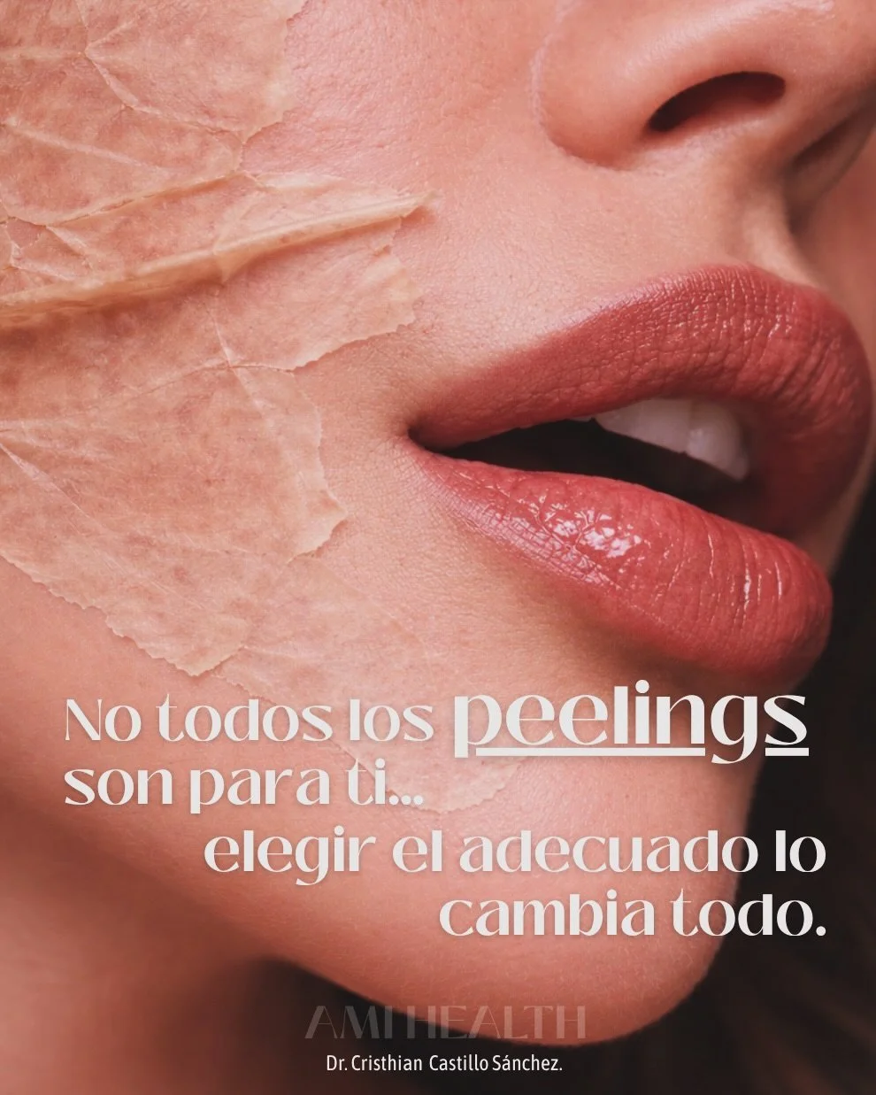 Renovar tu piel no tiene que ser complicado y en AMI Health te ayudados a hacerlo. 

En consulta trabajamos con peelings de grado m&eacute;dico, formulados para ayudarte a mejorar la textura, iluminar el rostro y devolverle vitalidad a tu piel de for