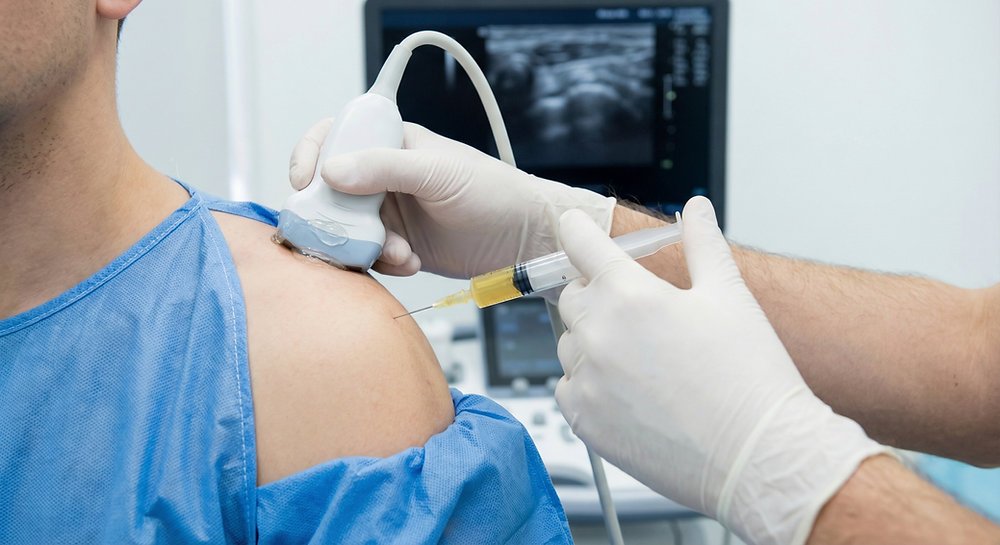 Fine Tuning Fitness-PRP injection with imaging-Upstate SC