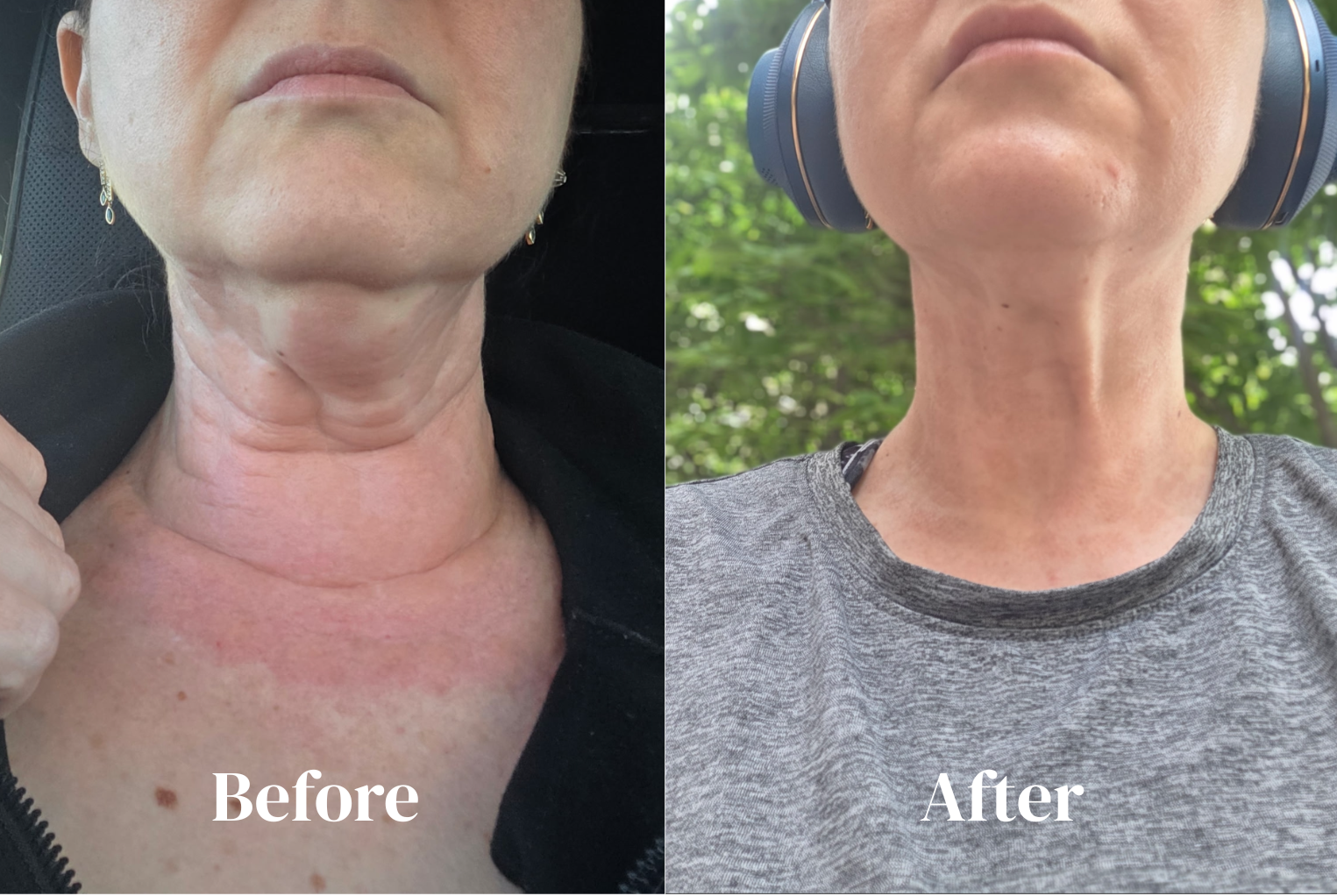 Neck Morphues 8 .png