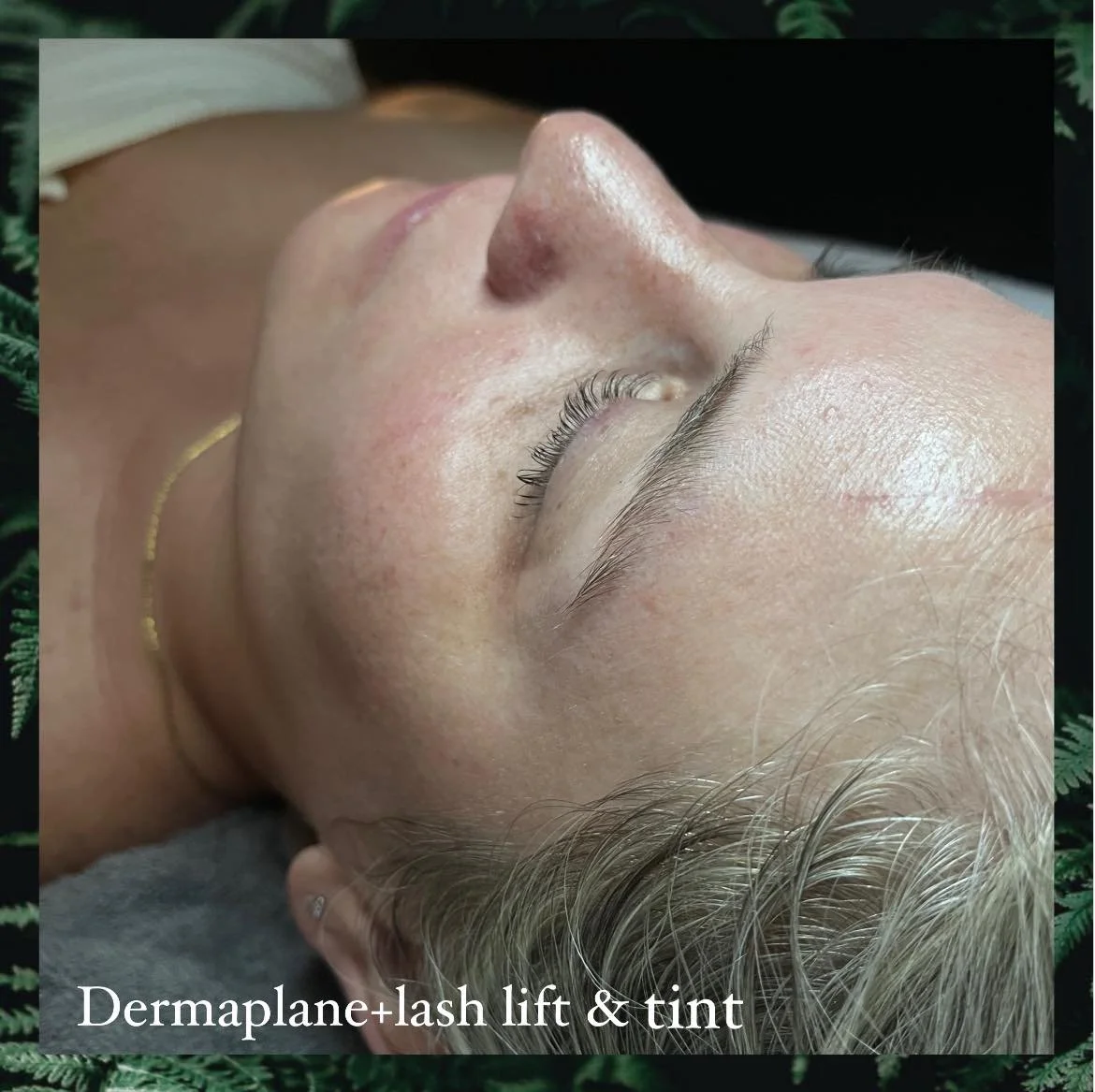 Close-up of a woman's face with her eyes closed, showing her skin and eyelashes, after a dermaplane treatment, eyelash lift, and tint. Text at the bottom reads 'Dermaplane+lack lift & tint.'