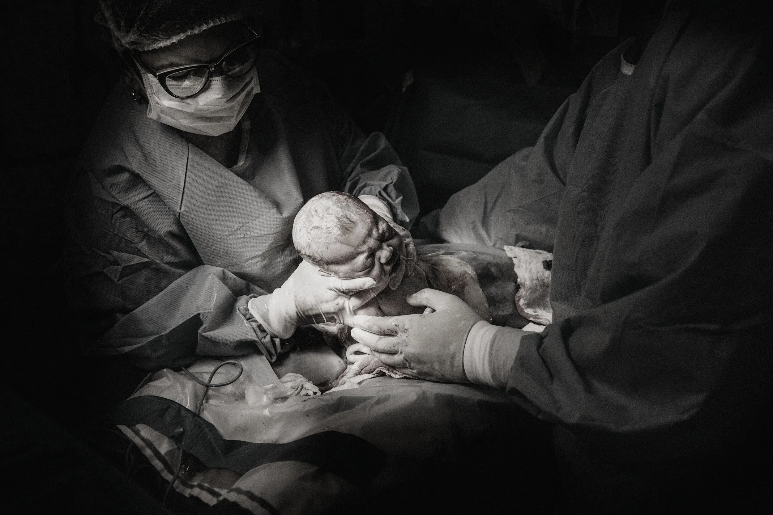 Two medical professionals in protective gear perform a cesarean birth, delivering a baby in a surgical setting.