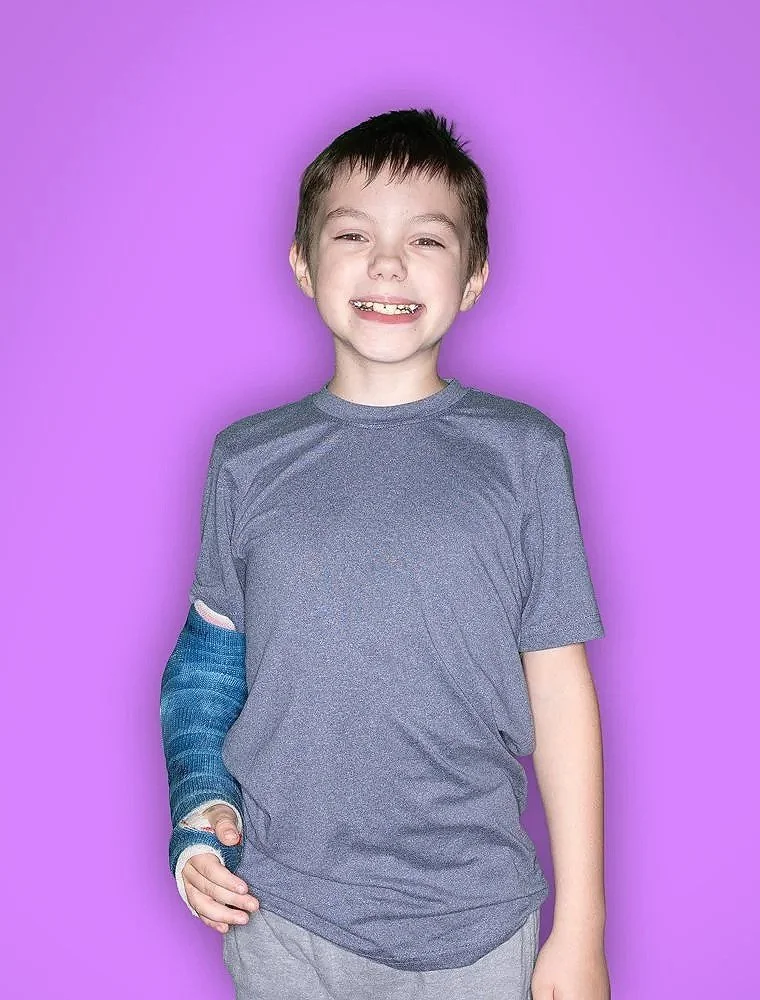 Young boy with a cast on his left arm, smiling and standing against a purple background.