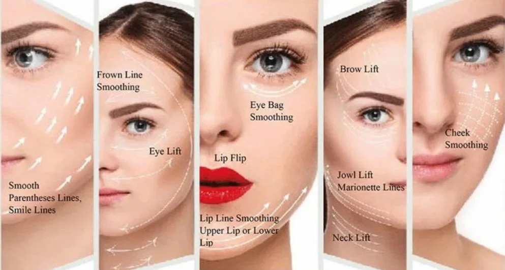 A guide showing various facial lifting and smoothing techniques, including smoothing of parentheses, smile lines, brow lift, eye bag smoothing, lip flip, jaw lift, marionette lines, neck lift, and cheek smoothing.