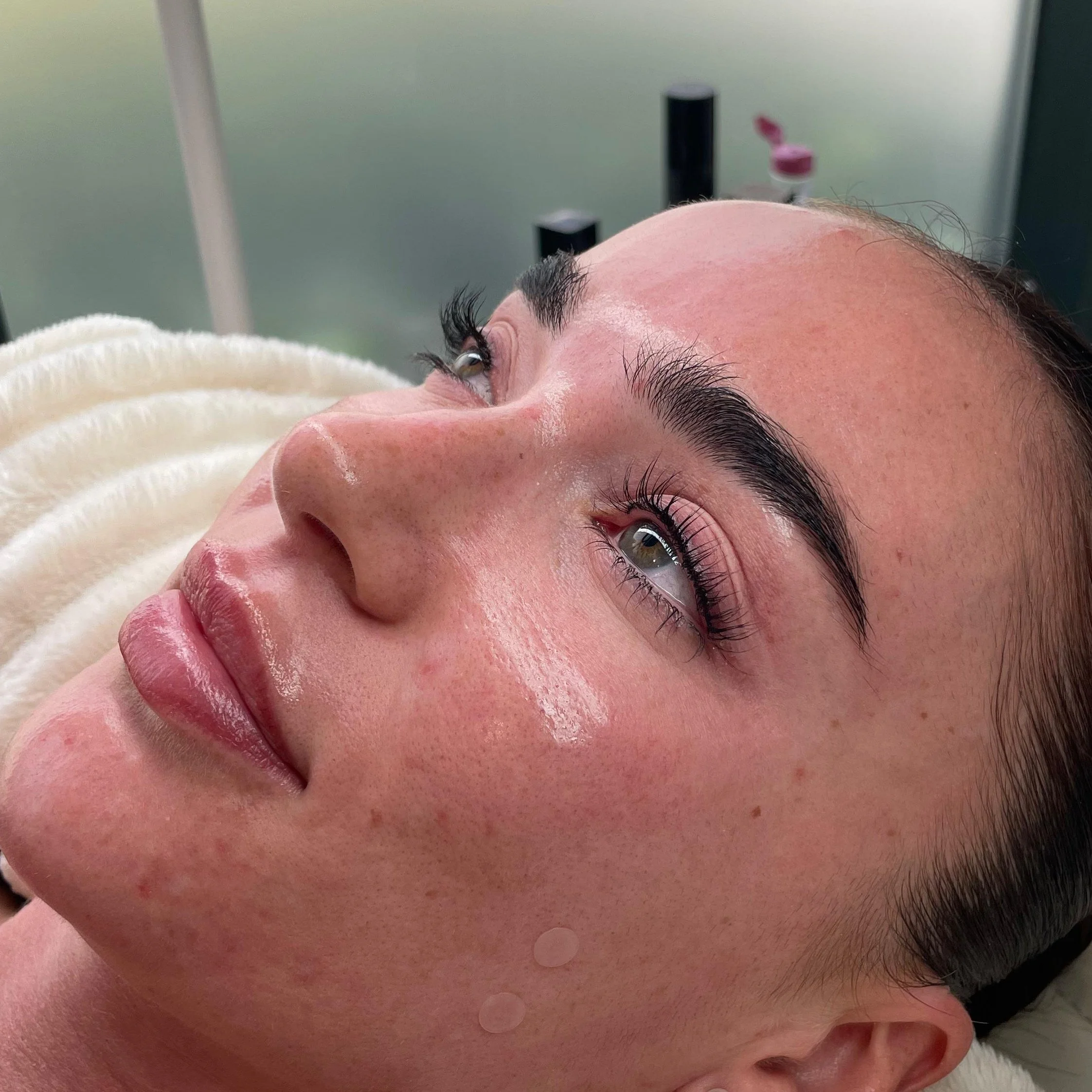 Close-up of a woman with dark eyebrows, lying on her side, with a serene expression, in a clinical setting.