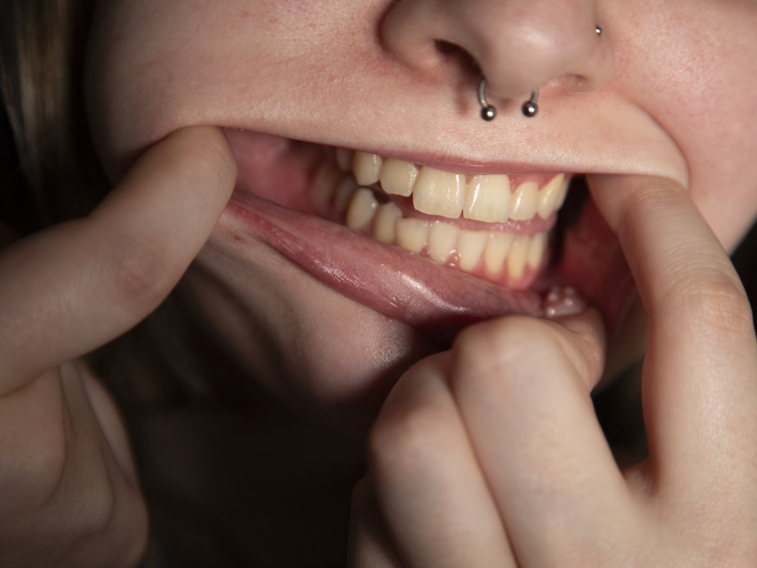 Whats_in_your_Mouth.jpeg