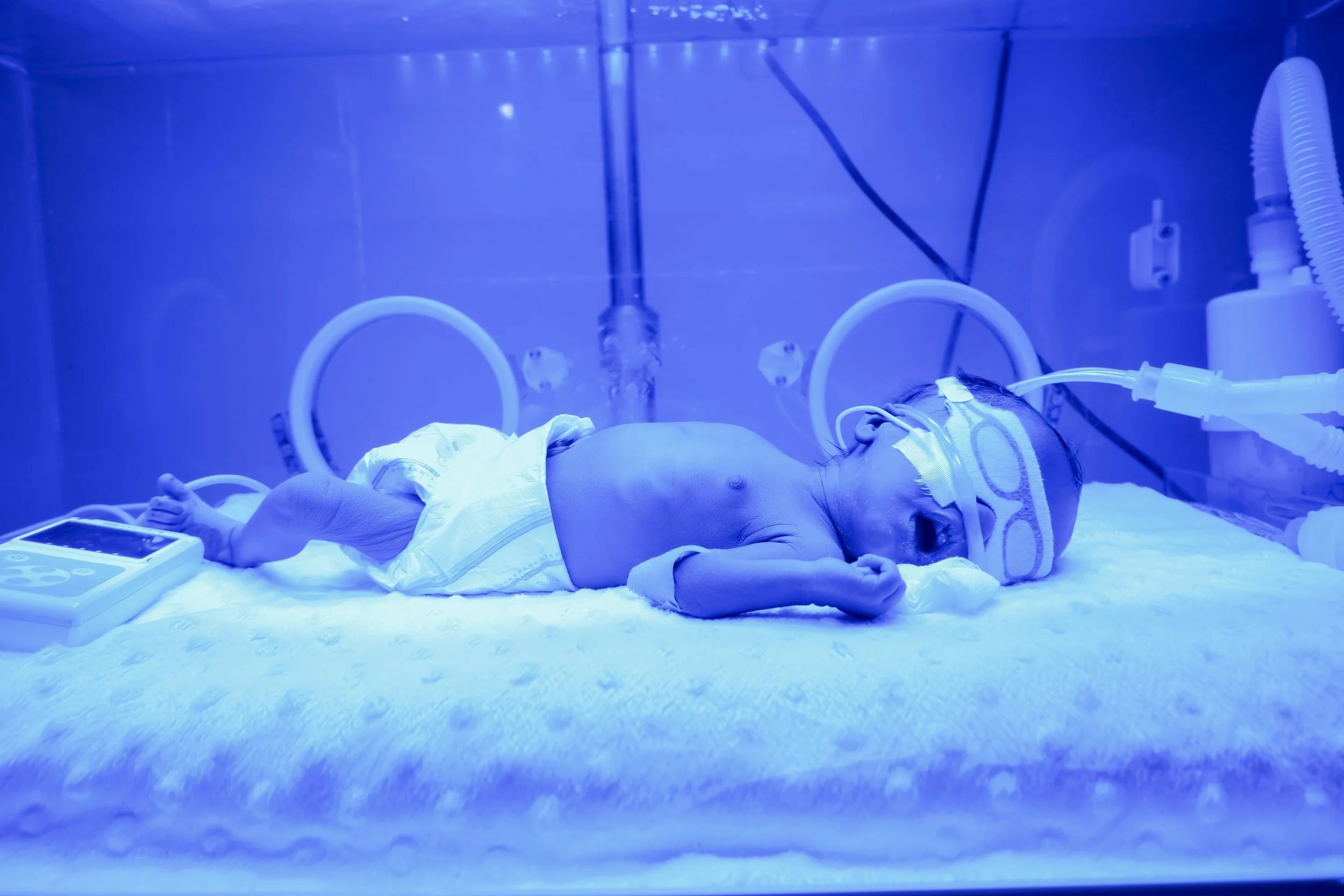 Baby in NICU.JPG