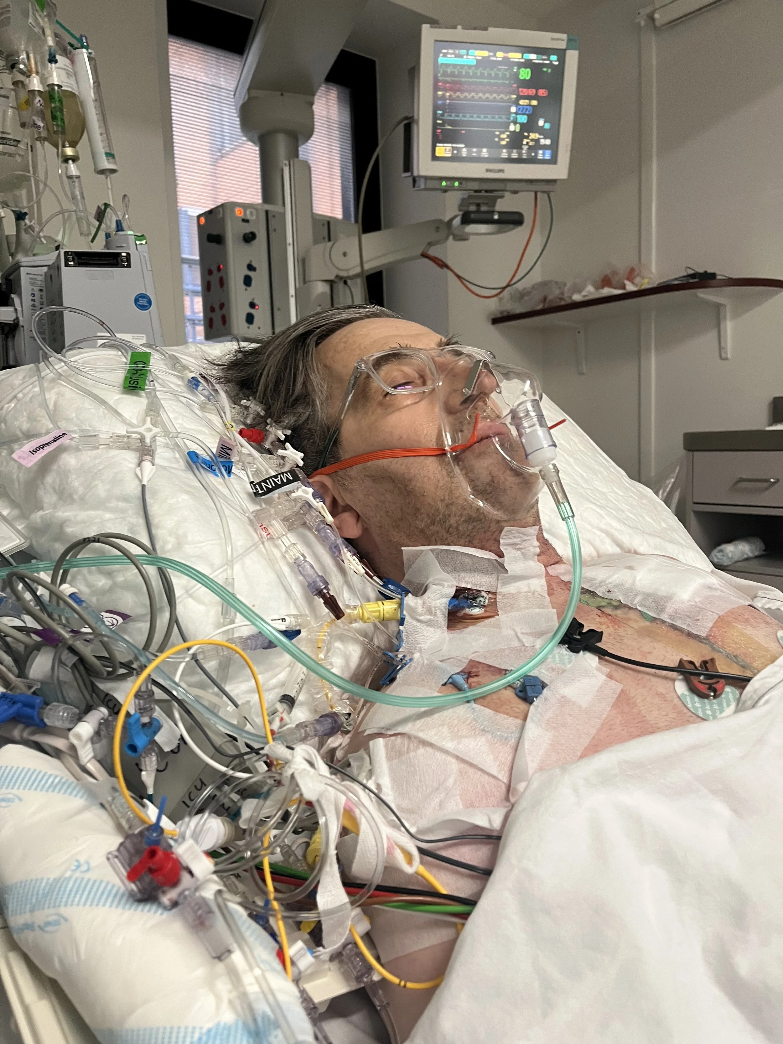 A man in a hospital bed wearing a breathing mask, with numerous medical tubes and wires attached, in a medical room with monitors and equipment.