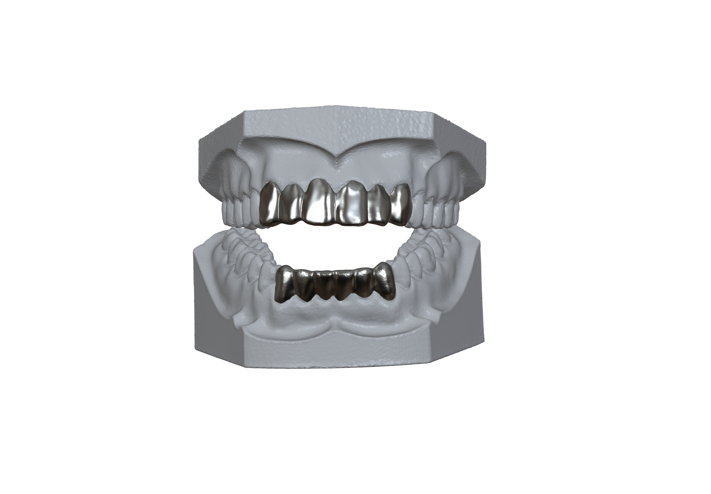6x6 Front Set