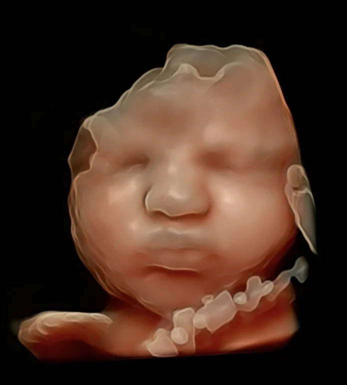5d-ultrasound-perth.jpg
